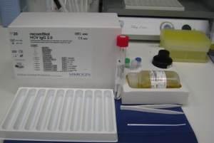 Recomblot HCV