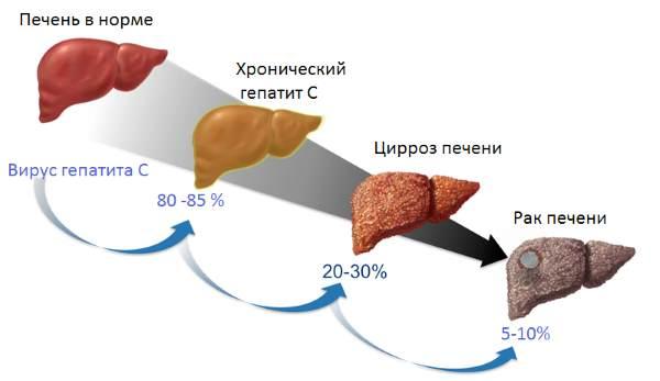 динамика прогрессирования болезни