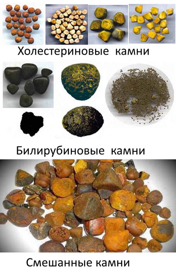 виды камней