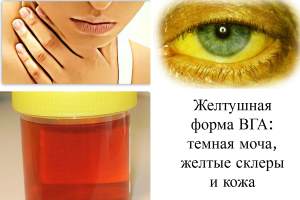 симптомы