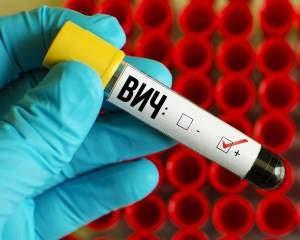 ВИЧ