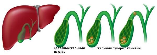 камни двигаются