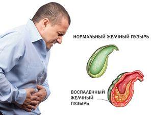 боль в желчном пузыре