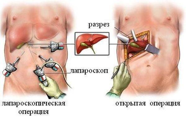 различия между операциями