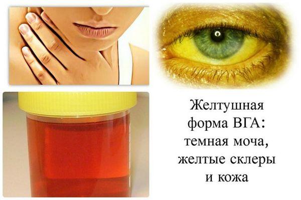 симптомы гепатита а