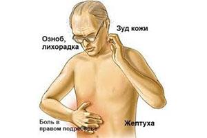 симптомы
