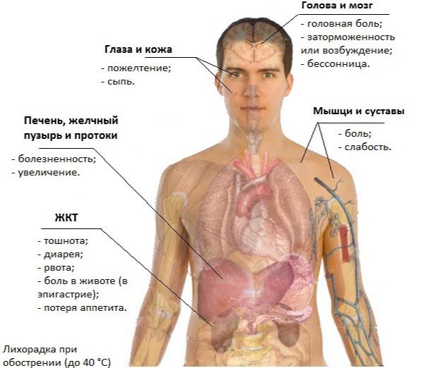 симптомы описторхоза