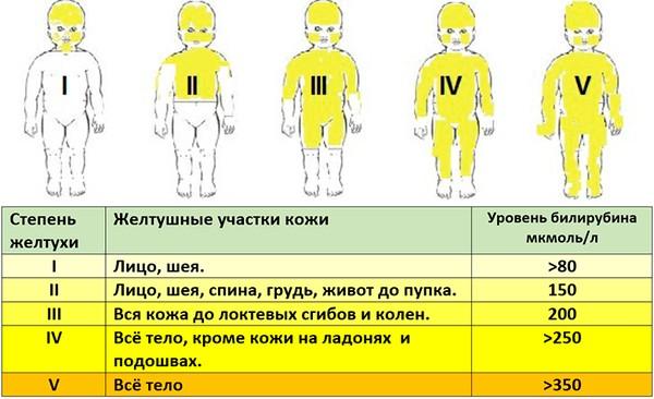 степени желтухи