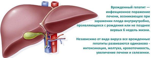 врожденный гепатит