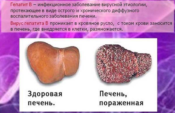 заражение печени гепатитом