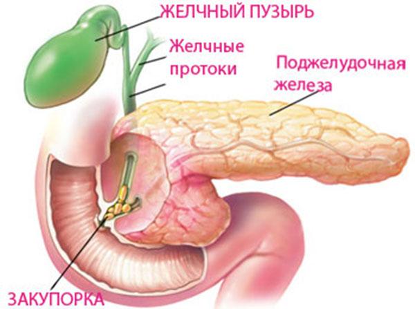 застой желчи