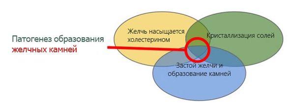 механизм образования камней