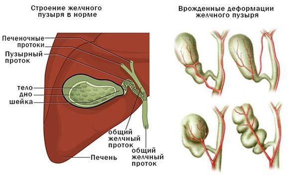 виды деформаций