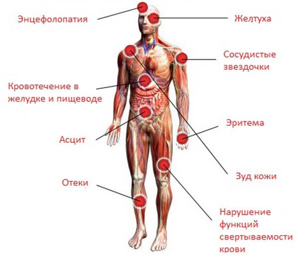 клинические проявления