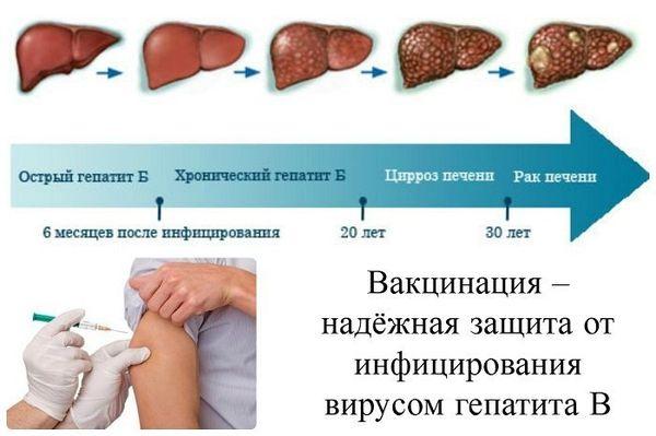 стадии поражения печени
