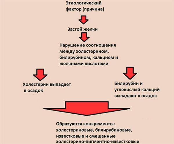 механизм образования камней