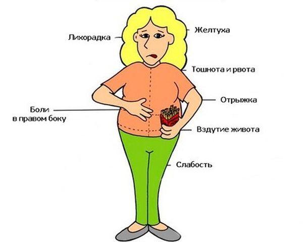 холецистит