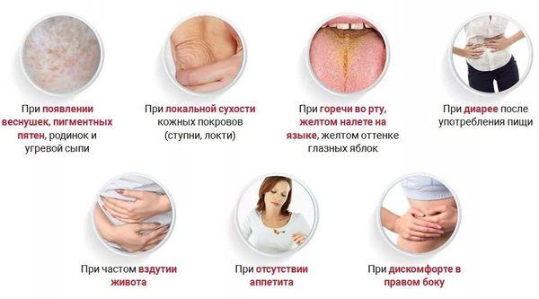 симптомы болезни печени