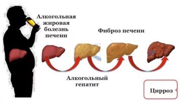 стадии алкогольной болезни