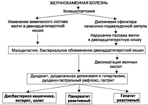желчнокаменная болезнь