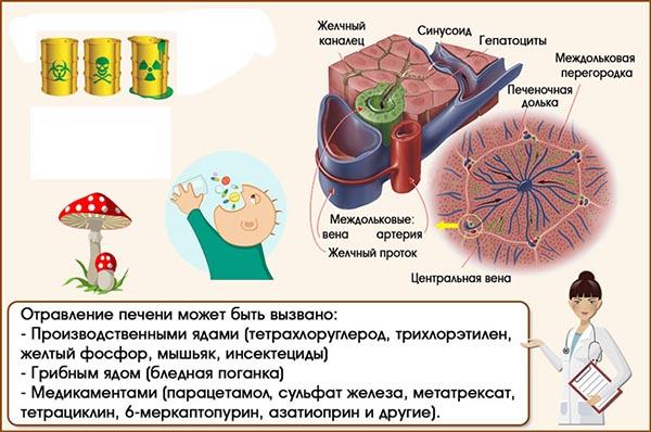 токсический гепатит