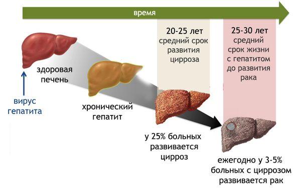 осложнения вирусных гепатитов