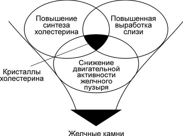 причины жкб