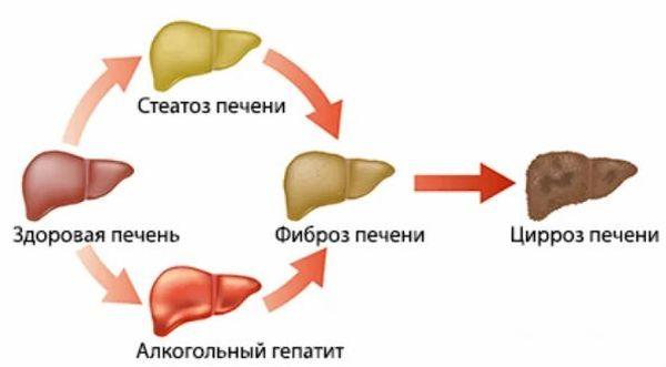 печень и алкоголь