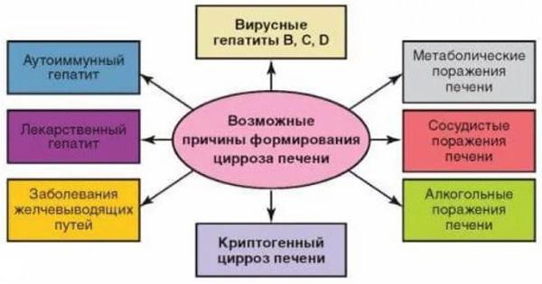 цирроз печени