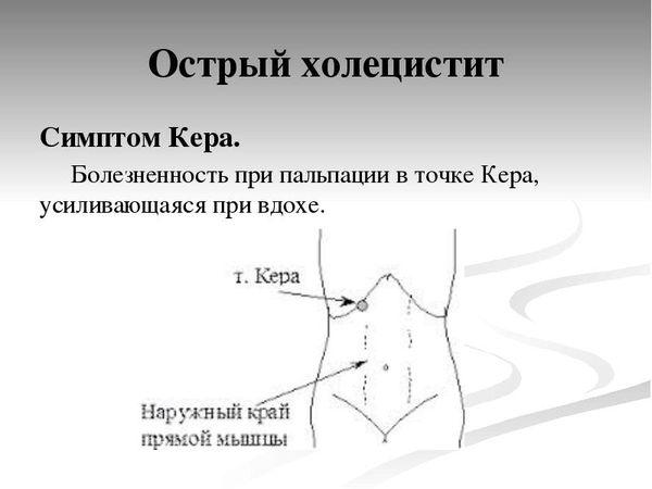 точка Кера