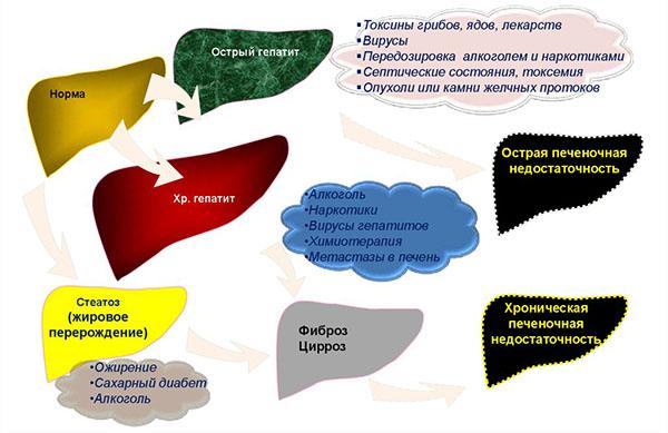 что вредит печени