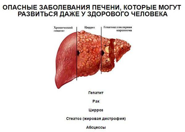 патологии печени