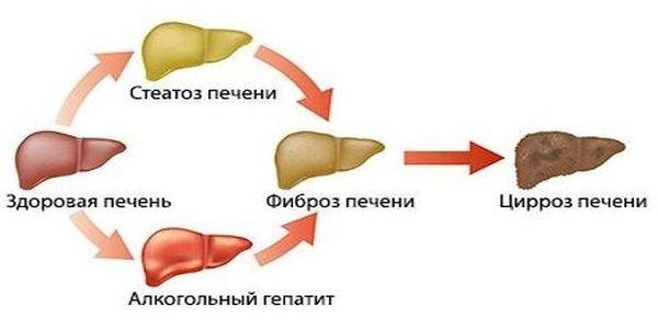 влияние алкоголя на печень