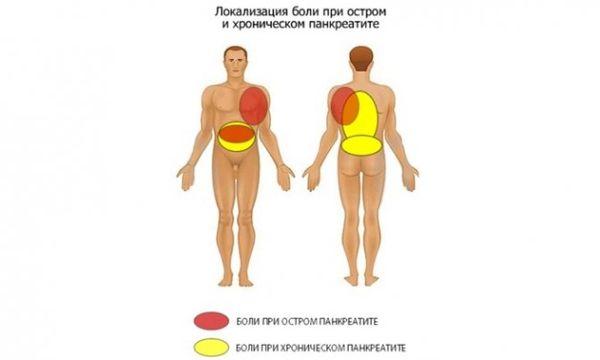 боль при панкреатите