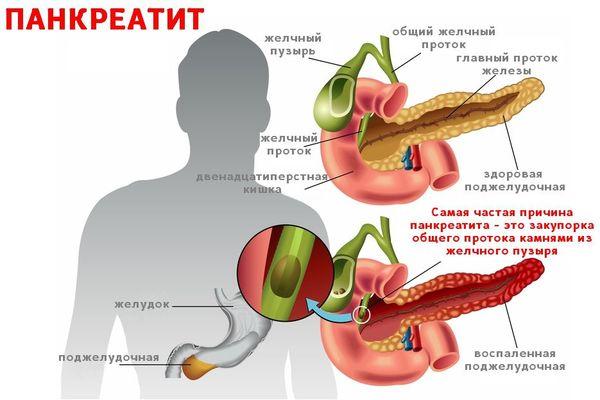 поджелудочная железа
