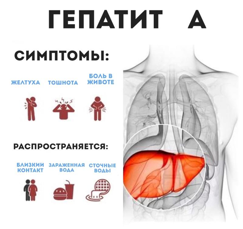 Гепатит А симптомы
