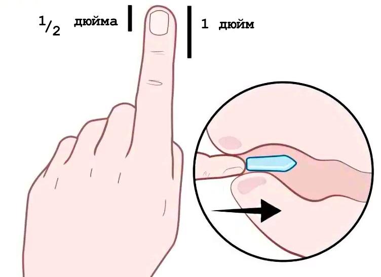 как вводить свечи