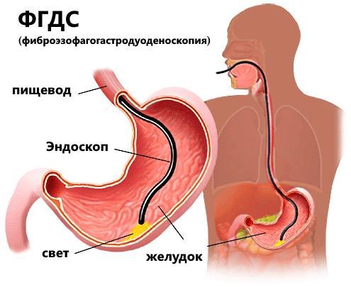 ФГДС