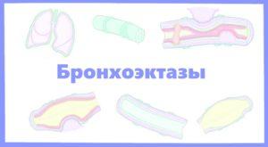 Бронхоэктазы
