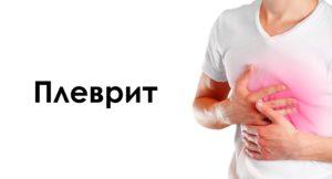 плеврит