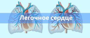 Легочное сердце