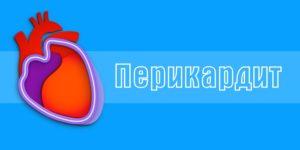 Перикардит