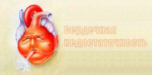 сердечная недостаточность