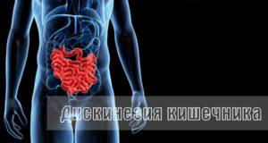 Дискинезия кишечника