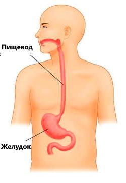 дискинезия пищевода