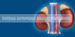 Острая почечная недостаточность