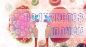 Поликистоз почек