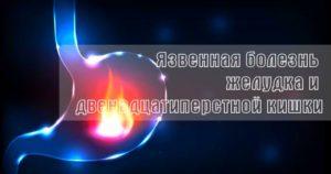 Язвенная болезнь желудка и двенадцатиперстной кишки