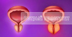 Простатит острый