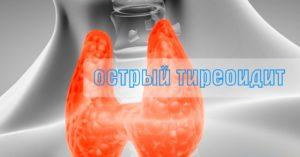 Тиреоидит острый признаки
